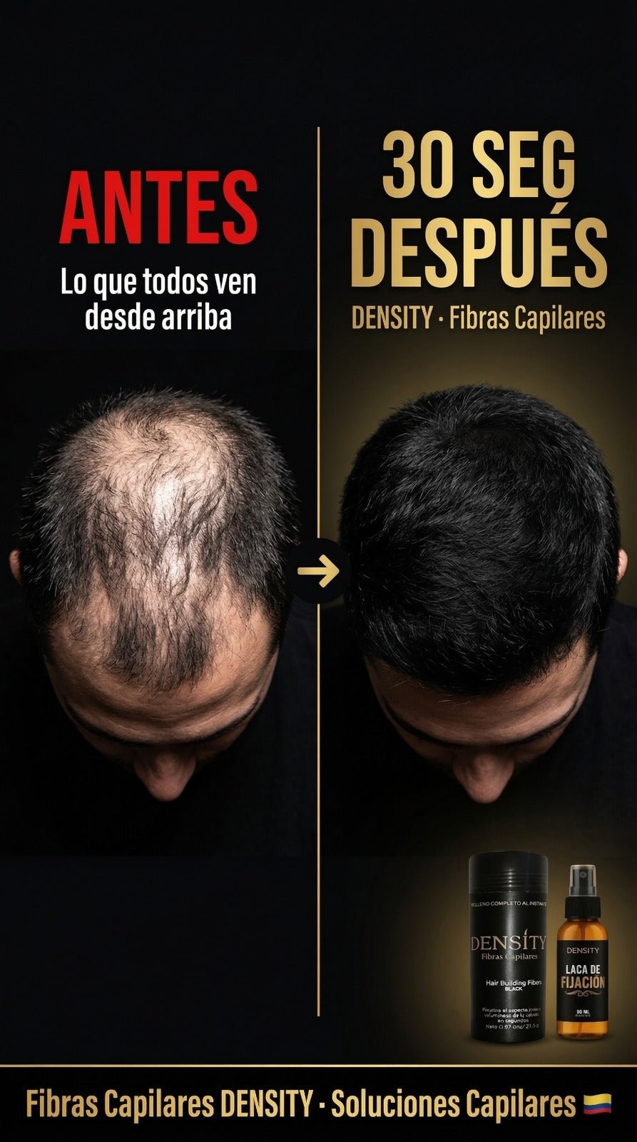 FRASCO DE FIBRA + LACA DE FIJACION DE OBSEQUIO - SOLUCIONES CAPILARESFRASCO DE FIBRA + LACA DE FIJACION DE OBSEQUIOSOLUCIONES CAPILARESFisico