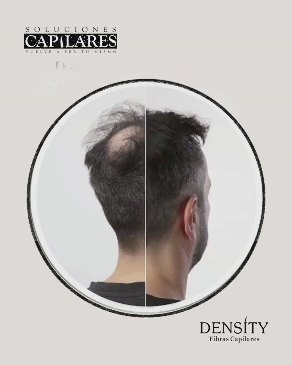 ATOMIZADOR O APLICADOR DE FIBRA